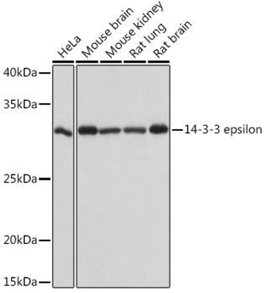 Immunology Antibodies 3 Anti-14-3-3 epsilon Antibody CAB4933