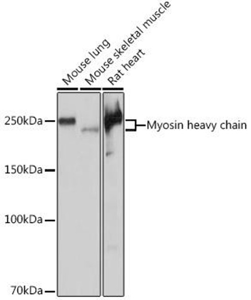 Cell Biology Antibodies 15 Anti-Myosin heavy chain Antibody CAB4963