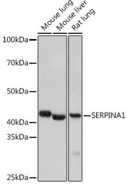 Immunology Antibodies 3 Anti-SERPINA1 Antibody CAB4966
