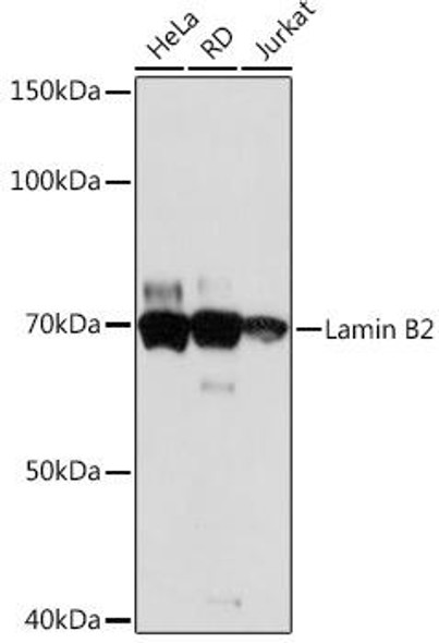 Cell Biology Antibodies 17 Anti-Lamin B2 Antibody CAB5001