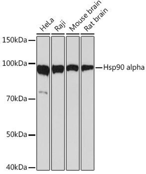Immunology Antibodies 3 Anti-Hsp90 alpha Antibody CAB5006