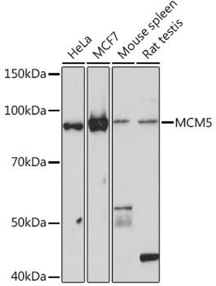 Cell Cycle Antibodies 2 Anti-MCM5 Antibody CAB5008