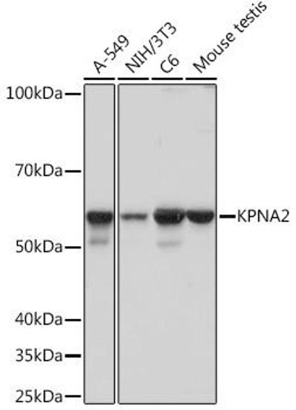 Immunology Antibodies 3 Anti-KPNA2 Antibody CAB5012