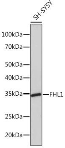 Developmental Biology Anti-FHL1 Antibody CAB5018