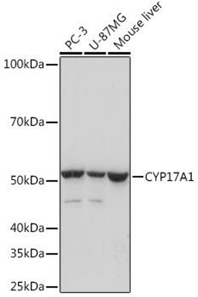 Metabolism Antibodies 3 Anti-CYP17A1 Antibody CAB5067