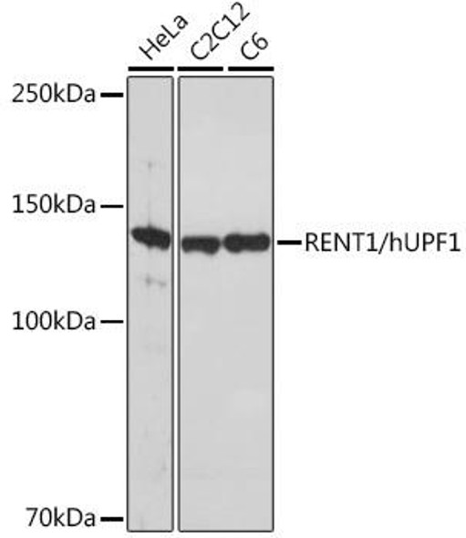 Immunology Antibodies 3 Anti-RENT1/hUPF1 Antibody CAB5071