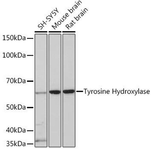 Metabolism Antibodies 3 Anti-Tyrosine Hydroxylase Antibody CAB5079