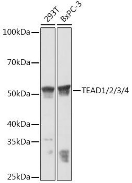 Cell Biology Antibodies 15 Anti-TEAD1/2/3/4 Antibody CAB5092