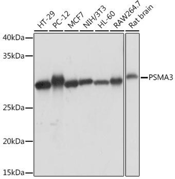 Immunology Antibodies 3 Anti-PSMA3 Antibody CAB5094