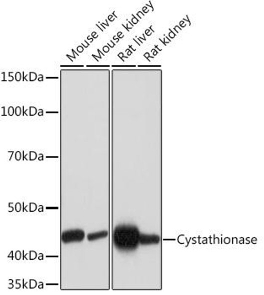 Metabolism Antibodies 3 Anti-Cystathionase Antibody CAB5101
