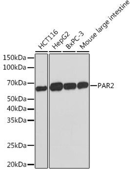 Immunology Antibodies 3 Anti-PAR2 Antibody CAB5103
