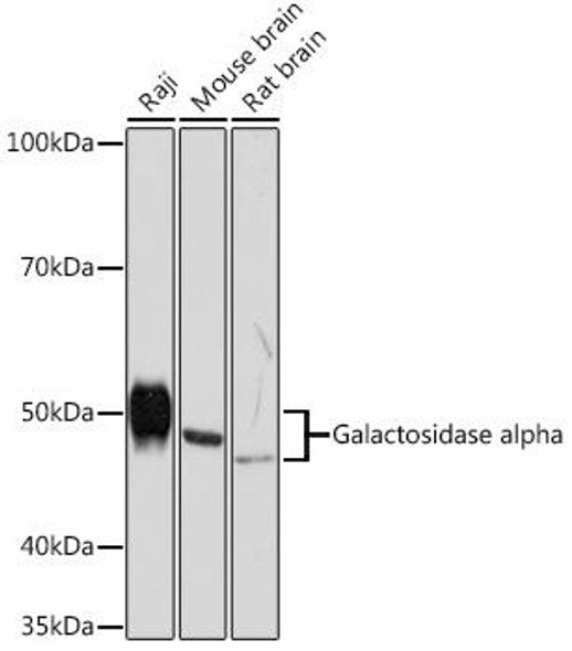 Cell Biology Antibodies 17 Anti-Galactosidase alpha Antibody CAB5119