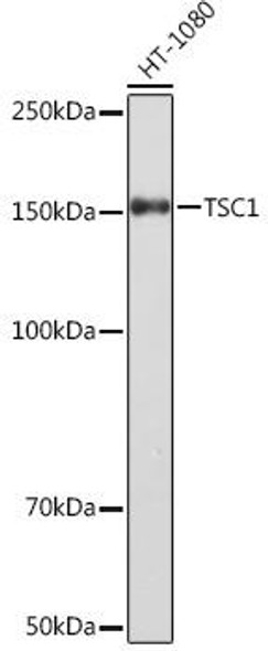 Cell Biology Antibodies 17 Anti-TSC1 Antibody CAB5121