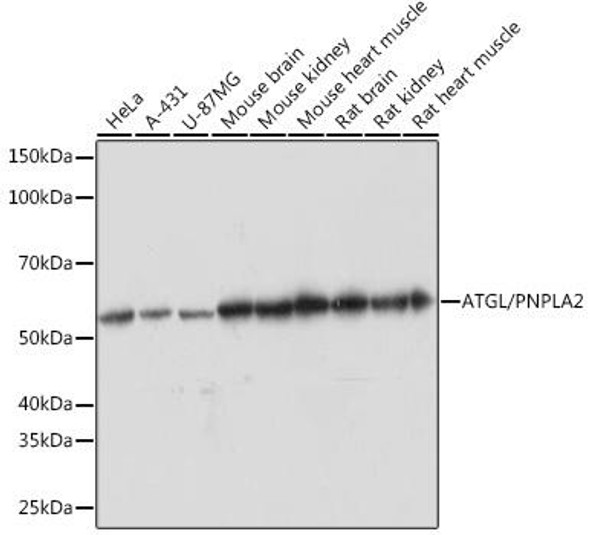 Metabolism Antibodies 3 Anti-ATGL/PNPLA2 Antibody CAB5126