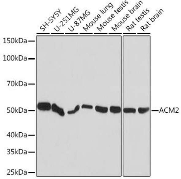 Cell Biology Antibodies 17 Anti-ACM2 Antibody CAB5154