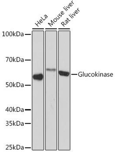 Metabolism Antibodies 3 Anti-Glucokinase Antibody CAB5170