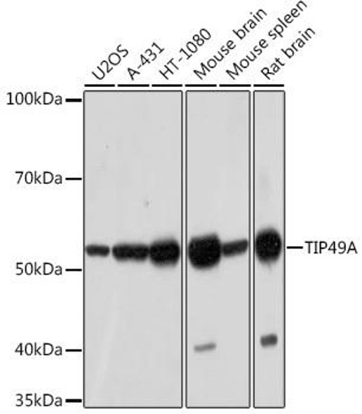 Cell Cycle Antibodies 2 Anti-TIP49A Antibody CAB5180