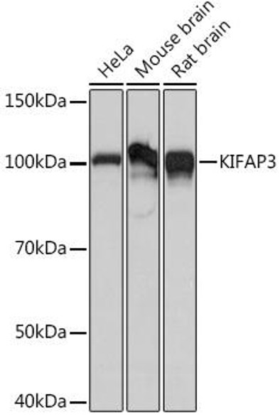 Cell Biology Antibodies 17 Anti-KIFAP3 Antibody CAB5216