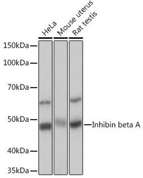 Cell Biology Antibodies 17 Anti-Inhibin beta A Antibody CAB5232