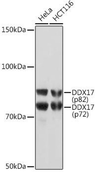 Immunology Antibodies 3 Anti-DDX17 Antibody CAB5731