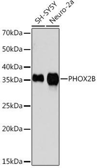 Epigenetics and Nuclear Signaling Antibodies 5 Anti-PHOX2B Antibody CAB6816