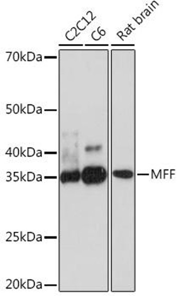 Cell Biology Antibodies 17 Anti-MFF Antibody CAB8700