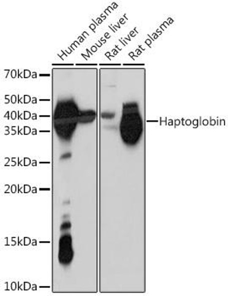 Immunology Antibodies 3 Anti-Haptoglobin Antibody CAB8778