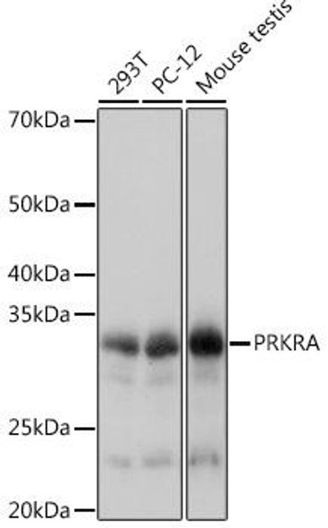 Immunology Antibodies 3 Anti-PRKRA Antibody CAB8779