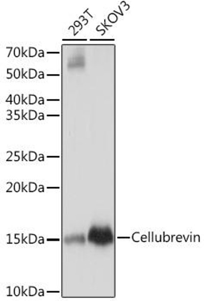 Cell Biology Antibodies 17 Anti-Cellubrevin Antibody CAB8812