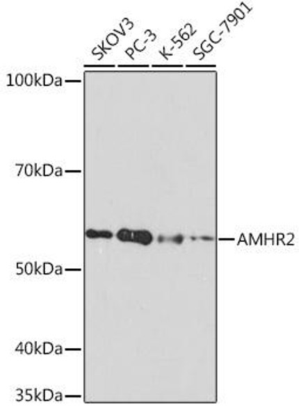 Cell Biology Antibodies 17 Anti-AMHR2 Antibody CAB8813