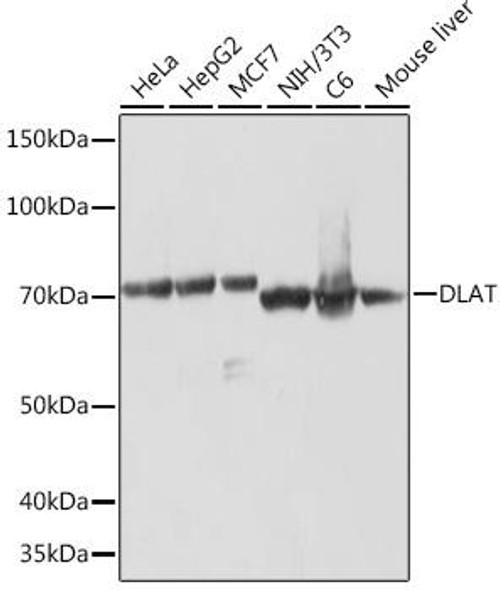 Metabolism Antibodies 3 Anti-DLAT Antibody CAB8814