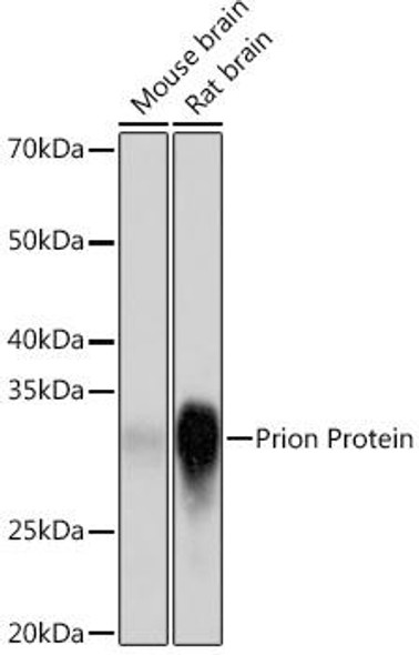 Cell Cycle Antibodies 2 Anti-Prion Protein Antibody CAB8821