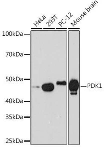 Metabolism Antibodies 3 Anti-PDK1 Antibody CAB8930