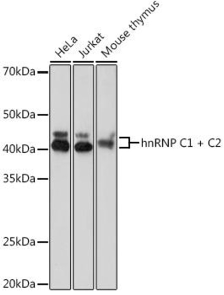 Cell Biology Antibodies 15 Anti-hnRNP C1 C2 Antibody CAB8958