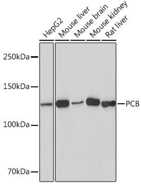 Metabolism Antibodies 3 Anti-PCB Antibody CAB8980