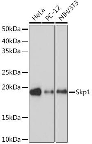 Immunology Antibodies 3 Anti-Skp1 Antibody CAB9021