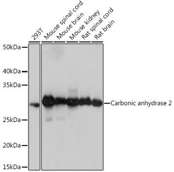 Cell Biology Antibodies 17 Anti-Carbonic anhydrase 2 Antibody CAB9148