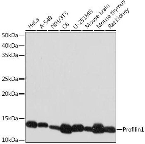 Cell Biology Antibodies 17 Anti-Profilin1 Antibody CAB9188