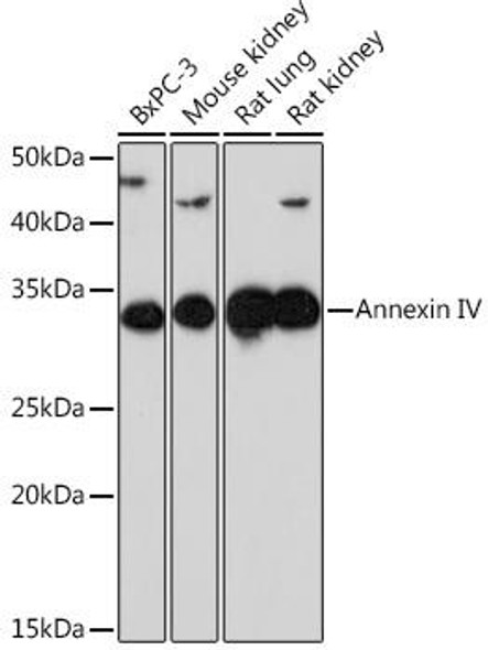 Cell Biology Antibodies 17 Anti-Annexin IV Antibody CAB9203