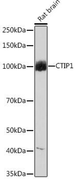 Epigenetics and Nuclear Signaling Antibodies 5 Anti-CTIP1 Antibody CAB9231