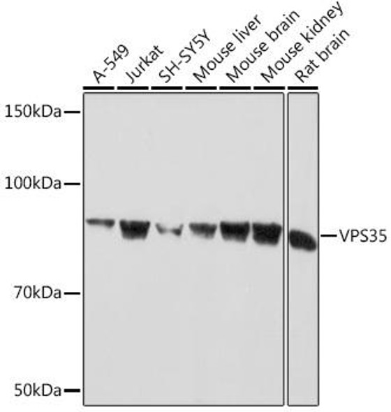 Immunology Antibodies 3 Anti-VPS35 Antibody CAB9278