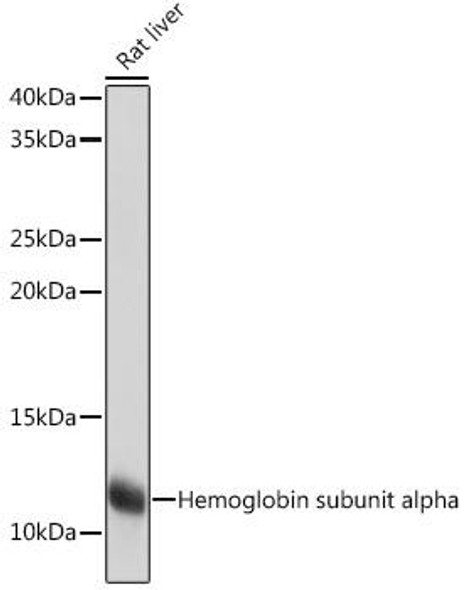 Signal Transduction Antibodies 3 Anti-Hemoglobin subunit alpha Antibody CAB9293
