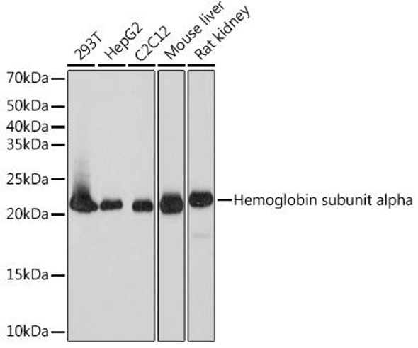 Immunology Antibodies 3 Anti-DHFR Antibody CAB9299