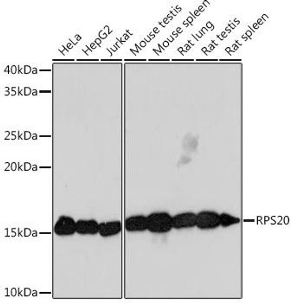 Cell Biology Antibodies 17 Anti-RPS20 Antibody CAB9551