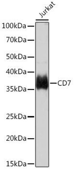 Immunology Antibodies 3 Anti-CD7 Antibody CAB9560