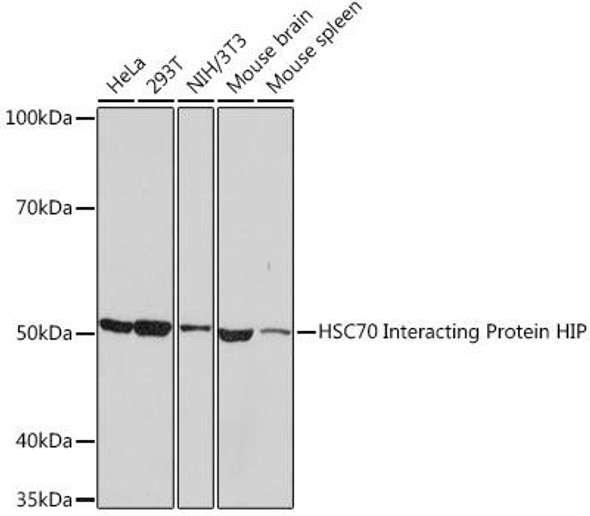 Cell Biology Antibodies 17 Anti-HSC70 Interacting Protein HIP Antibody CAB9567
