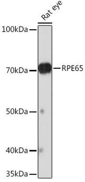 Signal Transduction Antibodies 3 Anti-RPE65 Antibody CAB9615
