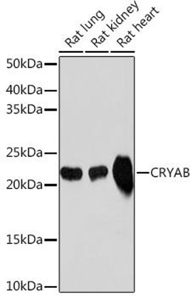 Cell Biology Antibodies 17 Anti-CRYAB Antibody CAB9633