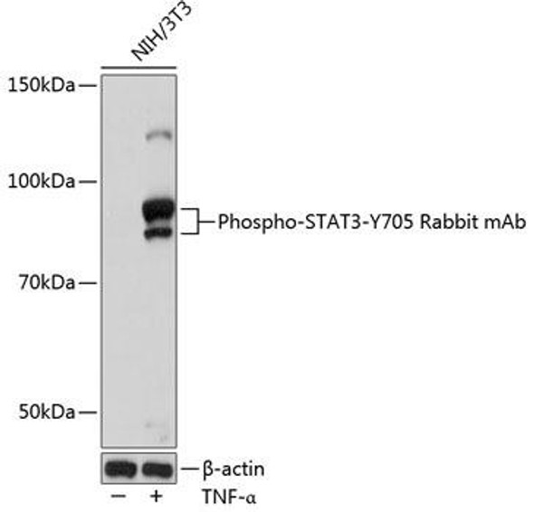 Immunology Antibodies 3 Anti-Phospho-STAT3-Y705 Antibody CABP0705