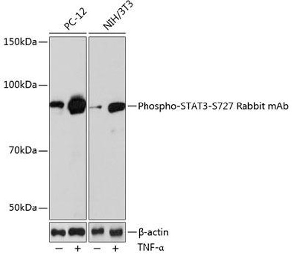 Immunology Antibodies 3 Anti-Phospho-STAT3-S727 Antibody CABP0715